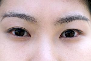 こだわりのある医療脱毛なら心斎橋のここ