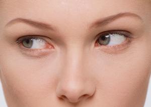 膣のゆるみが気になっている場合には