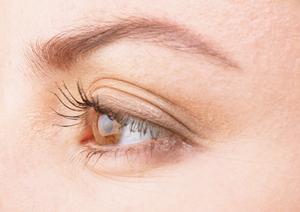 脂肪吸引の安全性と効果的な施術方法を徹底解説