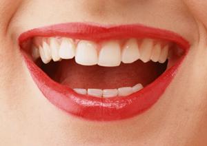 アイリフトでたるみが改善できます。